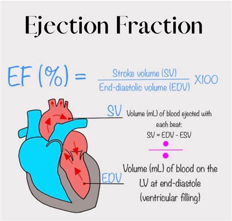 ejection fraction calculation formula|Ejection Fraction: What It Is, Types and Normal Range.
